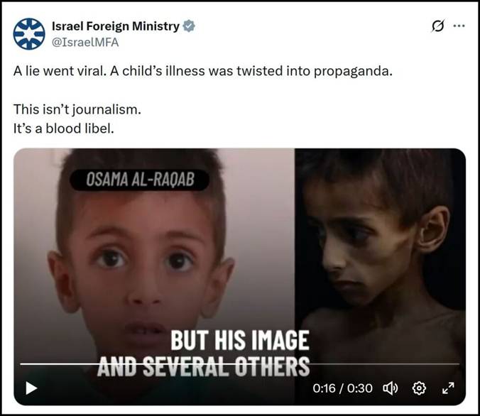 En lgn gikk viralt: En barnesykdom ble vridd til propaganda. I denne videoen kan du se barnet fr og etter medisinsk behandling. Hvordan kan det ha seg at journalistene ikke fikk med seg sannheten? spr Michal Rachel Suissa i denne kommentaren.
 Foto: Israelsk UD p X